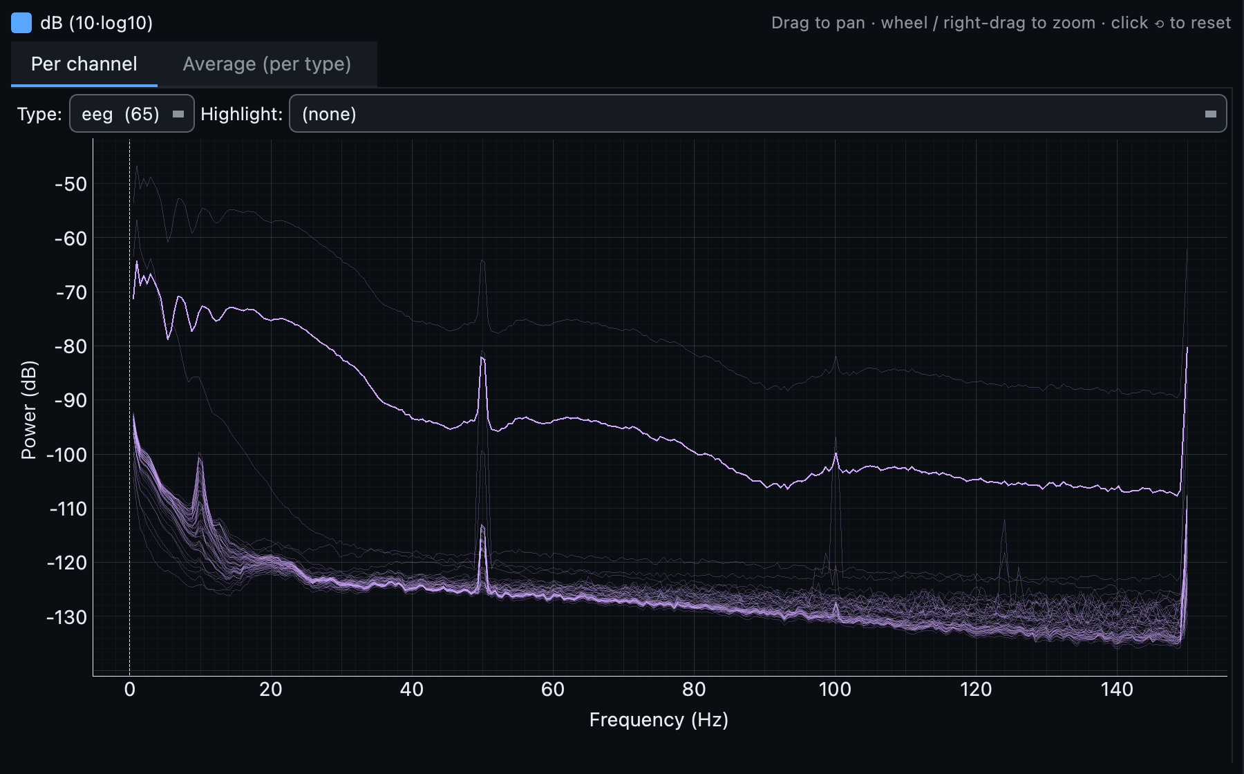 The power spectrum of an EEG recording, with a sharp peak at the mains frequency