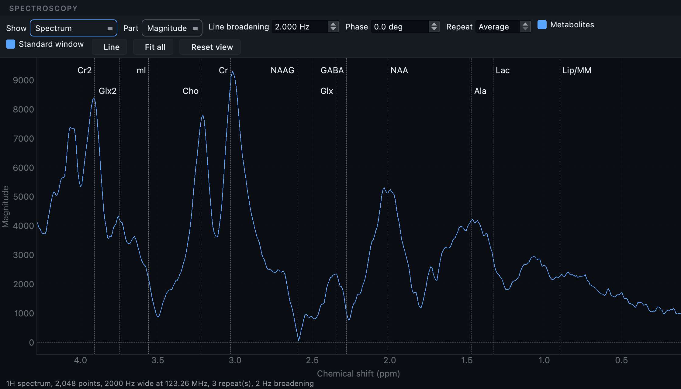 An MR spectrum with the chemical shift axis running right to left and the metabolite names staggered across two rows