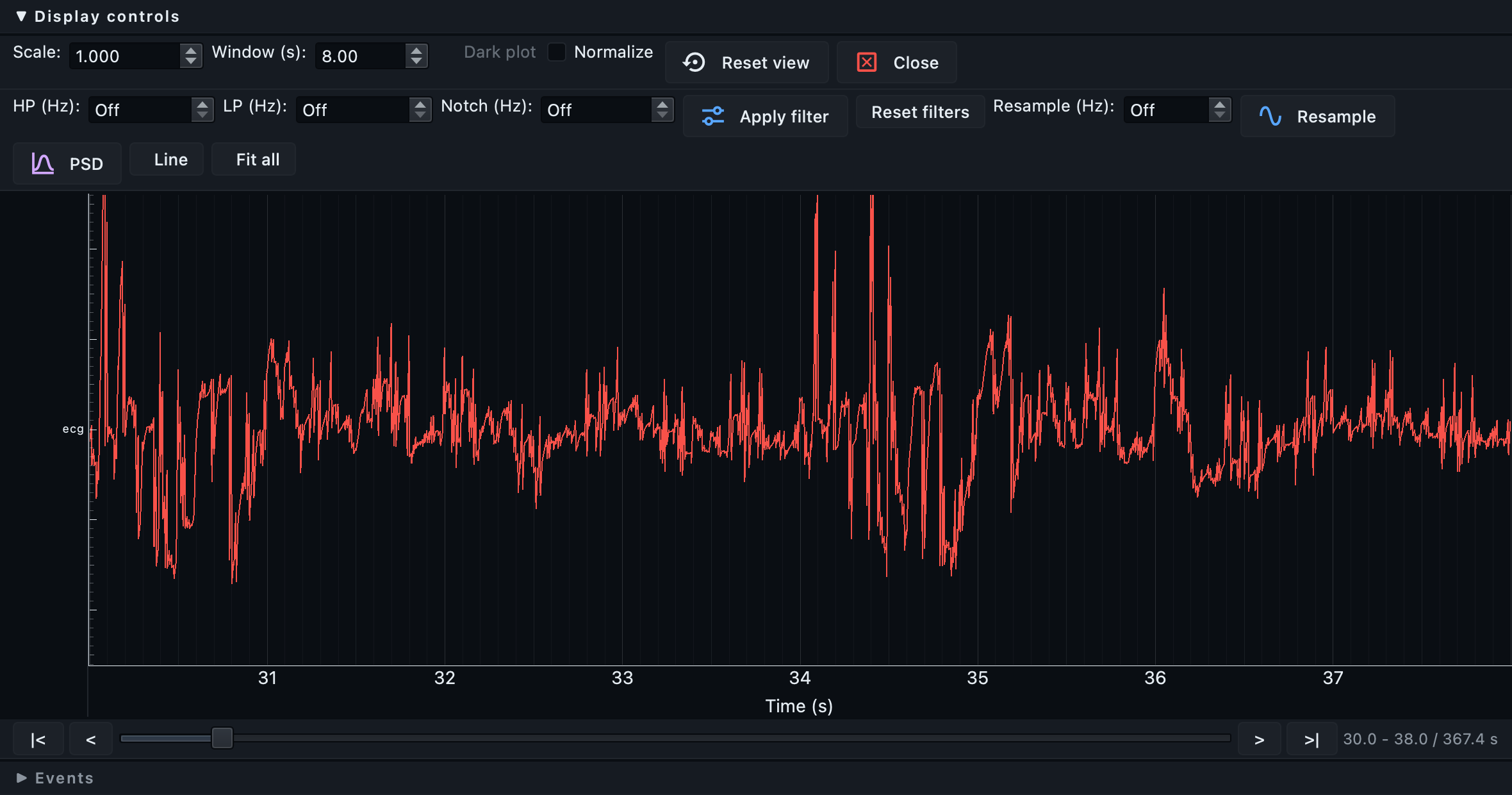 A single physiological channel in the shared signal viewer, with the channel-selection controls hidden