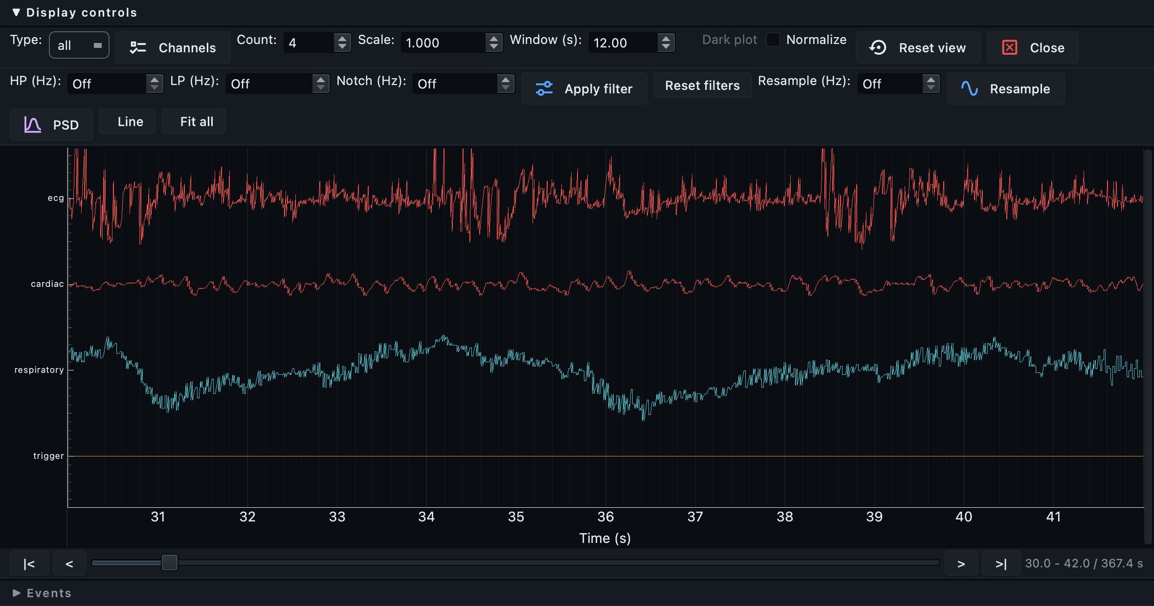 Four physiological recordings of one run drawn together on a single time axis