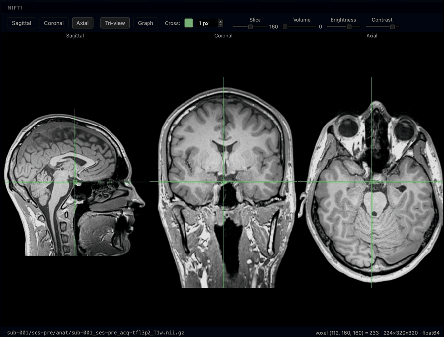 Screen recording of the BIDS Manager Editor NIfTI tri-view in dark mode: sagittal, coronal, and axial slices sharing one crosshair, with the 4-D graph tab for BOLD time series.