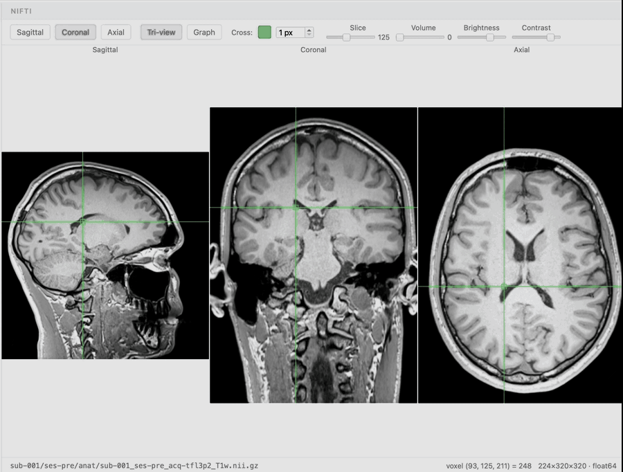 Screen recording of the BIDS Manager Editor NIfTI tri-view in light mode.