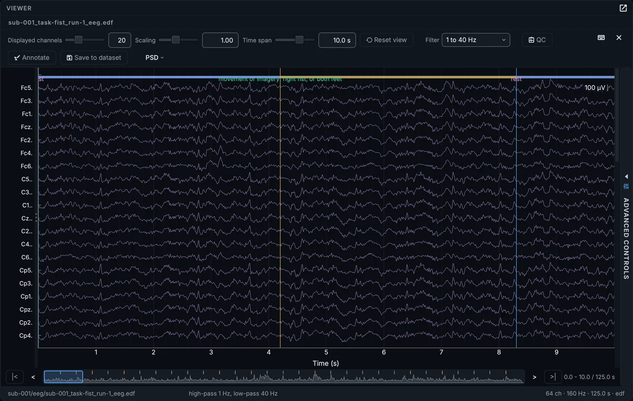 The first run of the fist task, converted, in the signal viewer: 20 of the 64 channels, filtered from 1 to 40 Hz, with the task's events drawn over them.