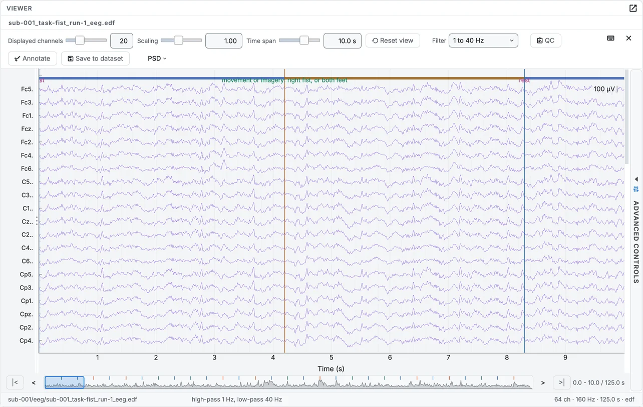 The first run of the fist task, converted, in the signal viewer: 20 of the 64 channels, filtered from 1 to 40 Hz, with the task's events drawn over them.