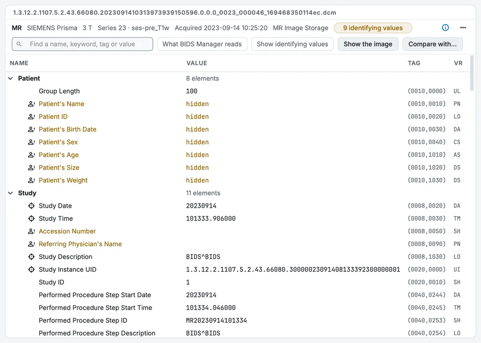 The DICOM header viewer of the T1w series: every element with its tag, and what BIDS Manager reads it for. Identifying values are hidden.