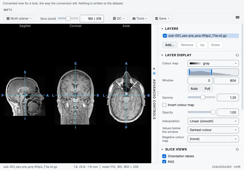 Preview the image on the T1w row: the series converted aside and shown in the viewer before anything is written to the dataset.