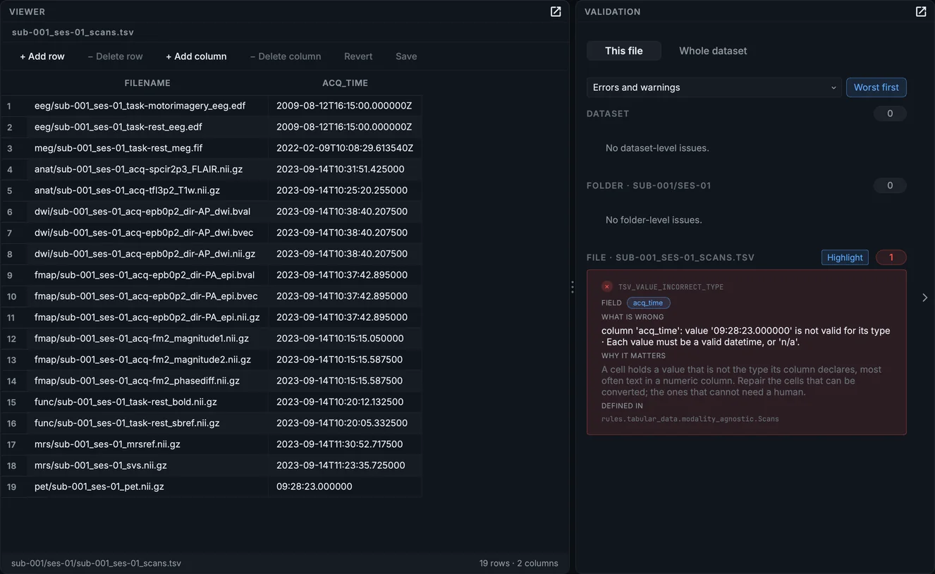 The session's scans table with the PET row's acquisition time marked, and the error in the Validation panel.