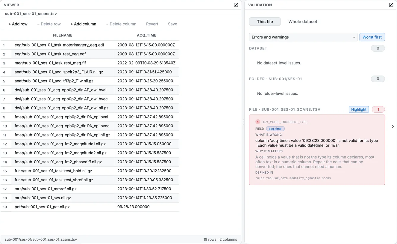 The session's scans table with the PET row's acquisition time marked, and the error in the Validation panel.
