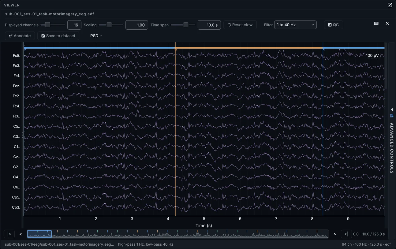 The motor-imagery EEG in the signal viewer: 16 channels filtered from 1 to 40 Hz, with the task's events drawn over the traces.
