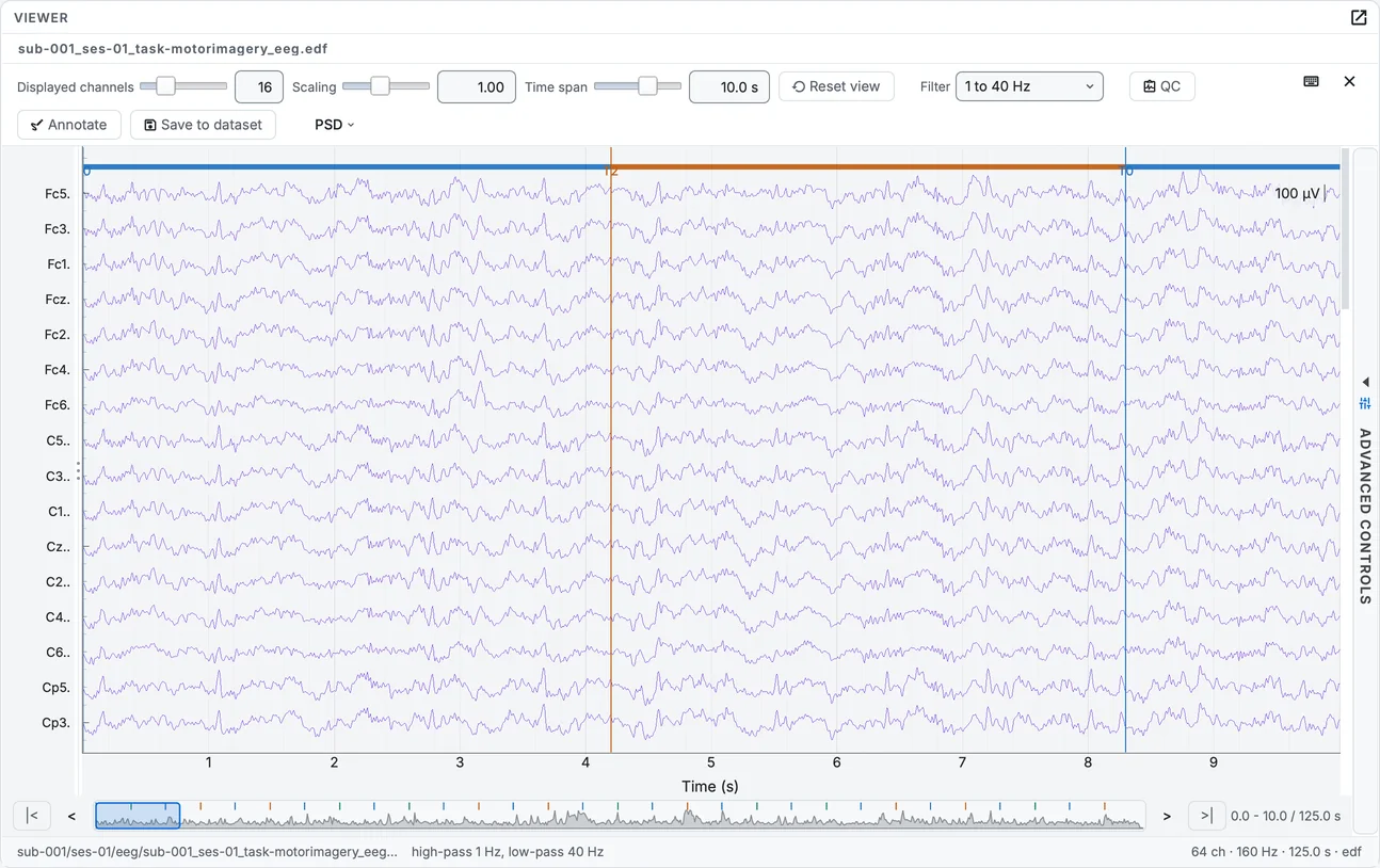 The motor-imagery EEG in the signal viewer: 16 channels filtered from 1 to 40 Hz, with the task's events drawn over the traces.