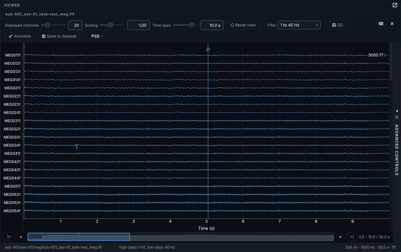 The resting MEG recording, its magnetometers.