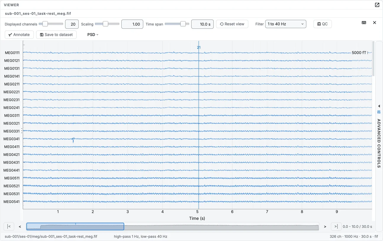 The resting MEG recording, its magnetometers.