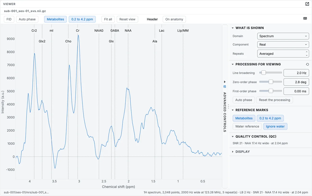 The spectroscopy file as a spectrum, with the chemical shift axis in ppm from right to left and the metabolites labelled.