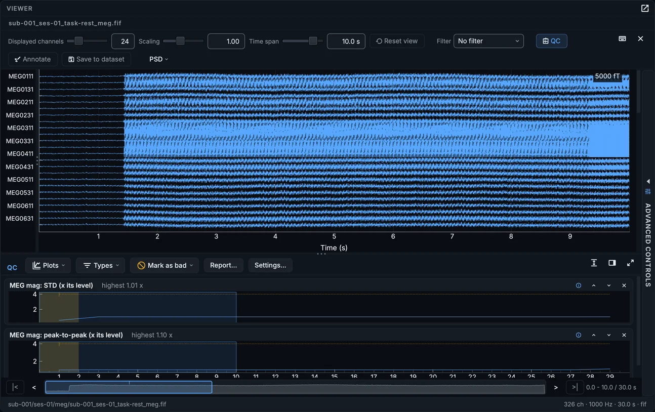 The MEG recording's quality check: each channel's level against its type, per segment, beside the traces.