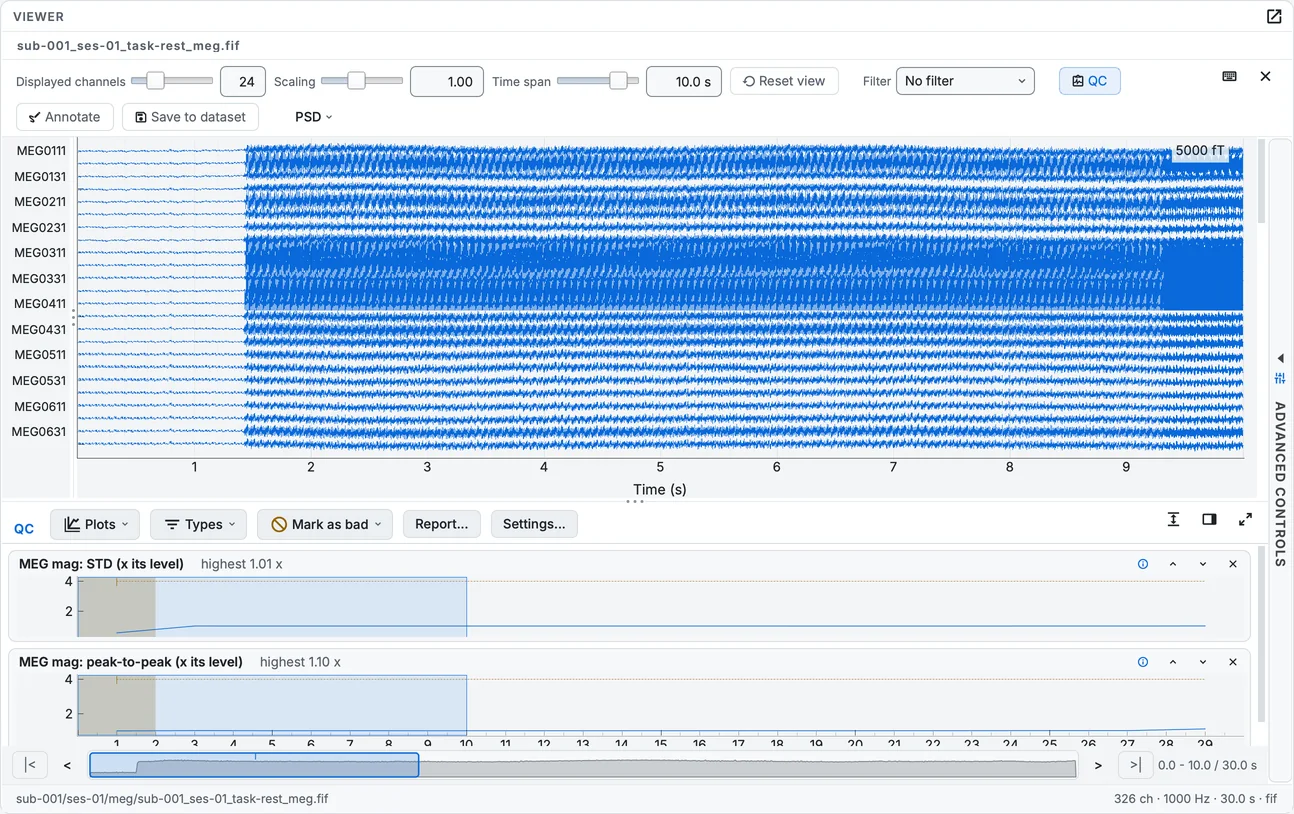 The MEG recording's quality check: each channel's level against its type, per segment, beside the traces.