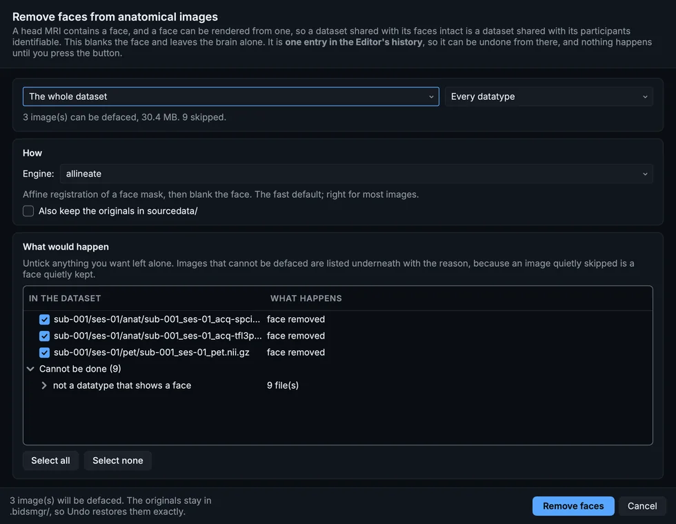 Remove faces: the dataset's anatomical images, the engine, and what would happen to each.