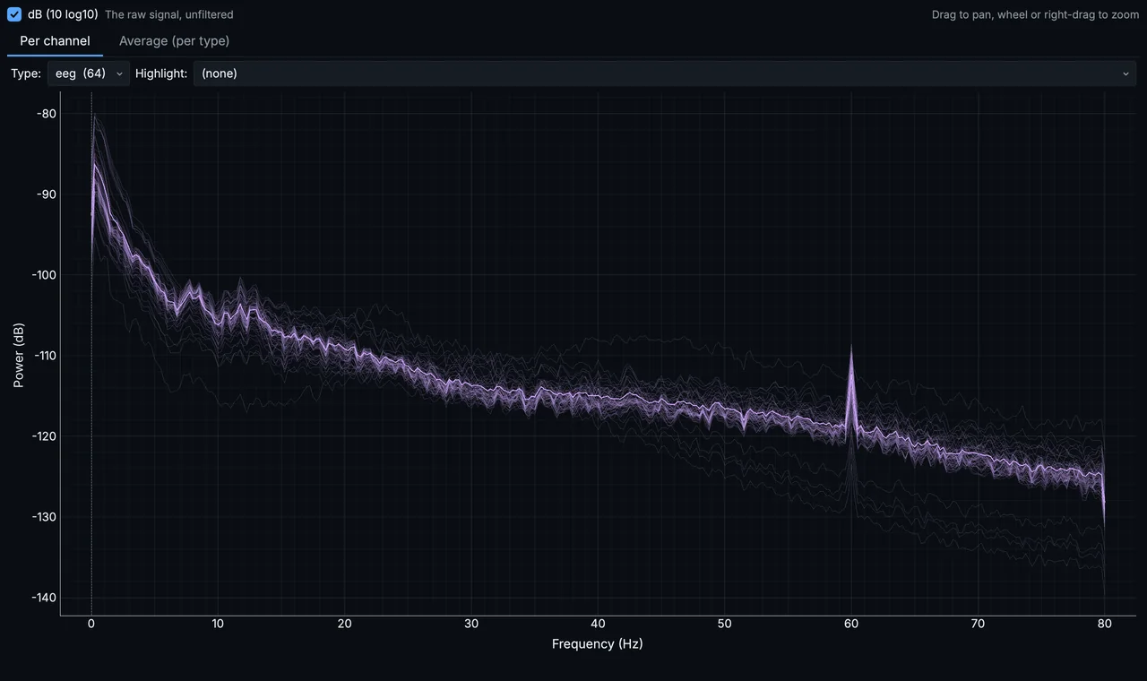 The power spectrum of the EEG recording: each channel's spectrum, with a crosshair that reads out frequency and power.