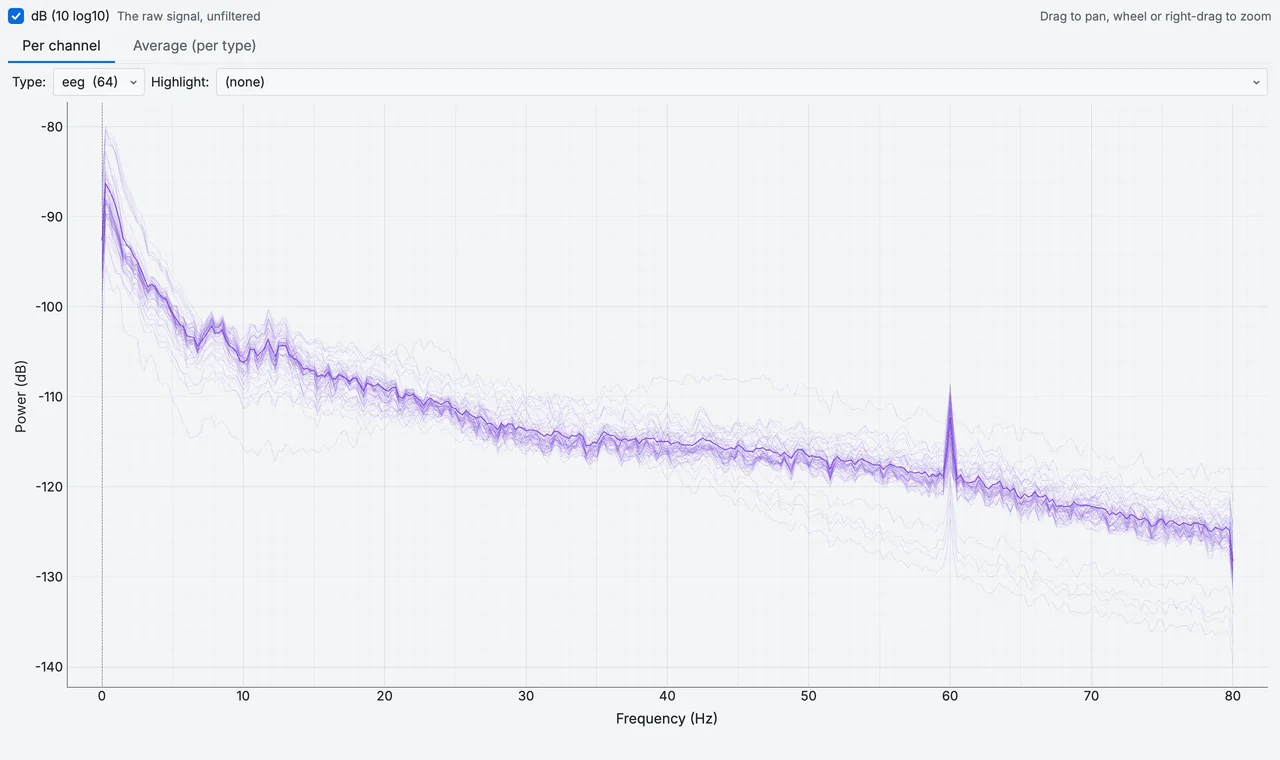 The power spectrum of the EEG recording: each channel's spectrum, with a crosshair that reads out frequency and power.