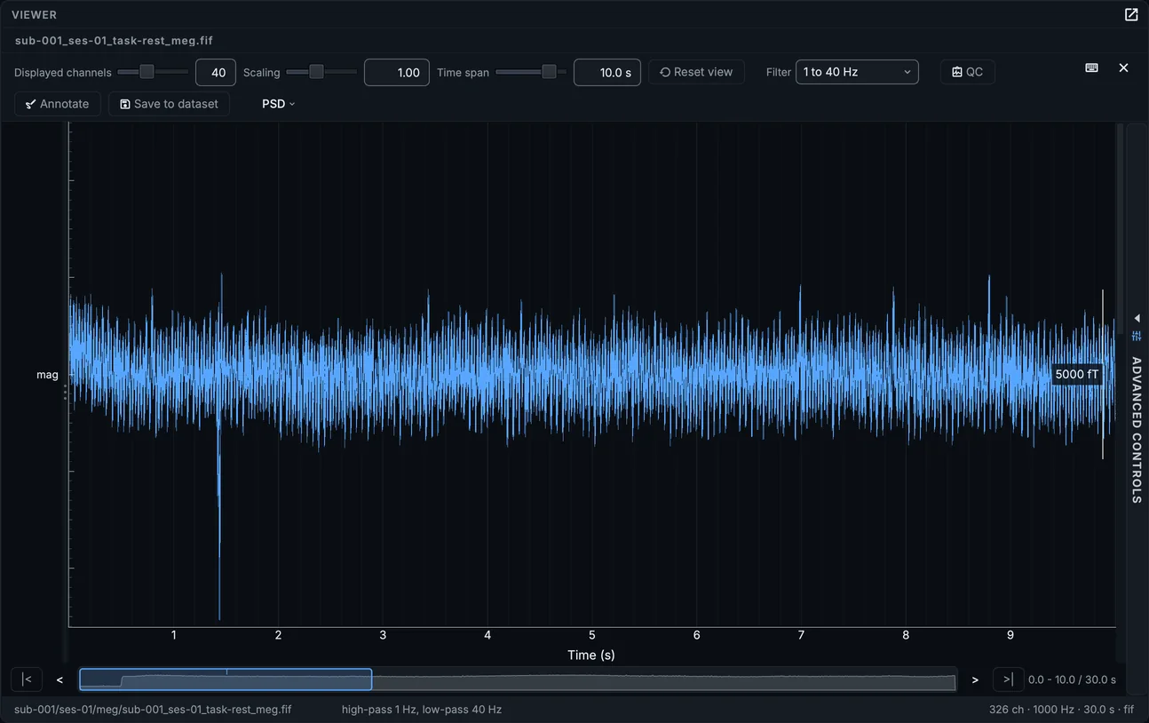 The MEG magnetometers in butterfly mode: every channel drawn on one axis.