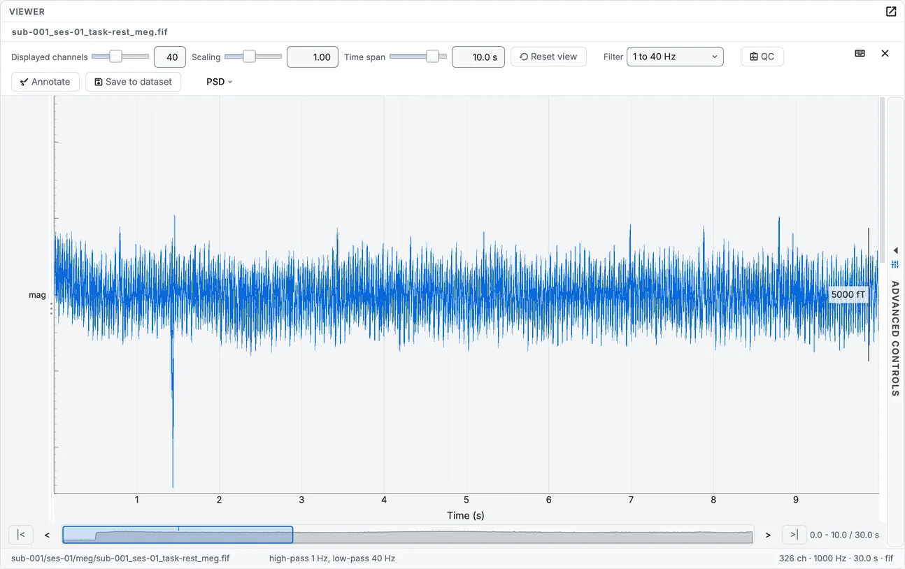 The MEG magnetometers in butterfly mode: every channel drawn on one axis.
