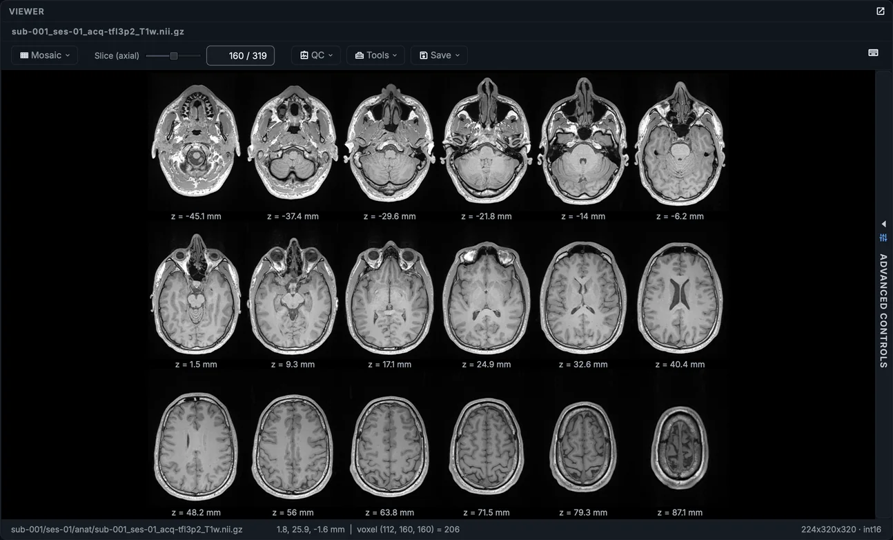 The T1w as a mosaic of axial slices.